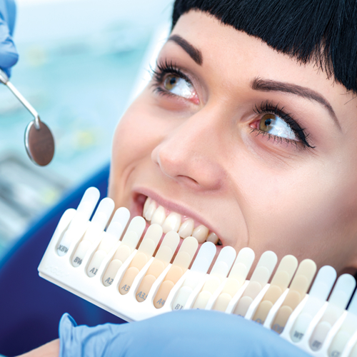 What Color are Your Teeth?
